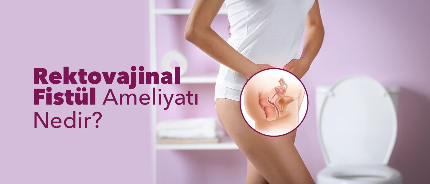 Rektovajinal Fistül Ameliyatı Nedir? Nasıl Yapılır? Riskleri ve İyileşme Süreci