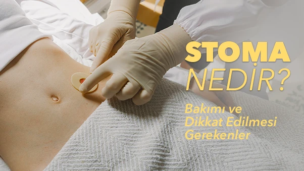Stoma Nedir? Kolostomi, İleostomi ve Ürostomi Farkı