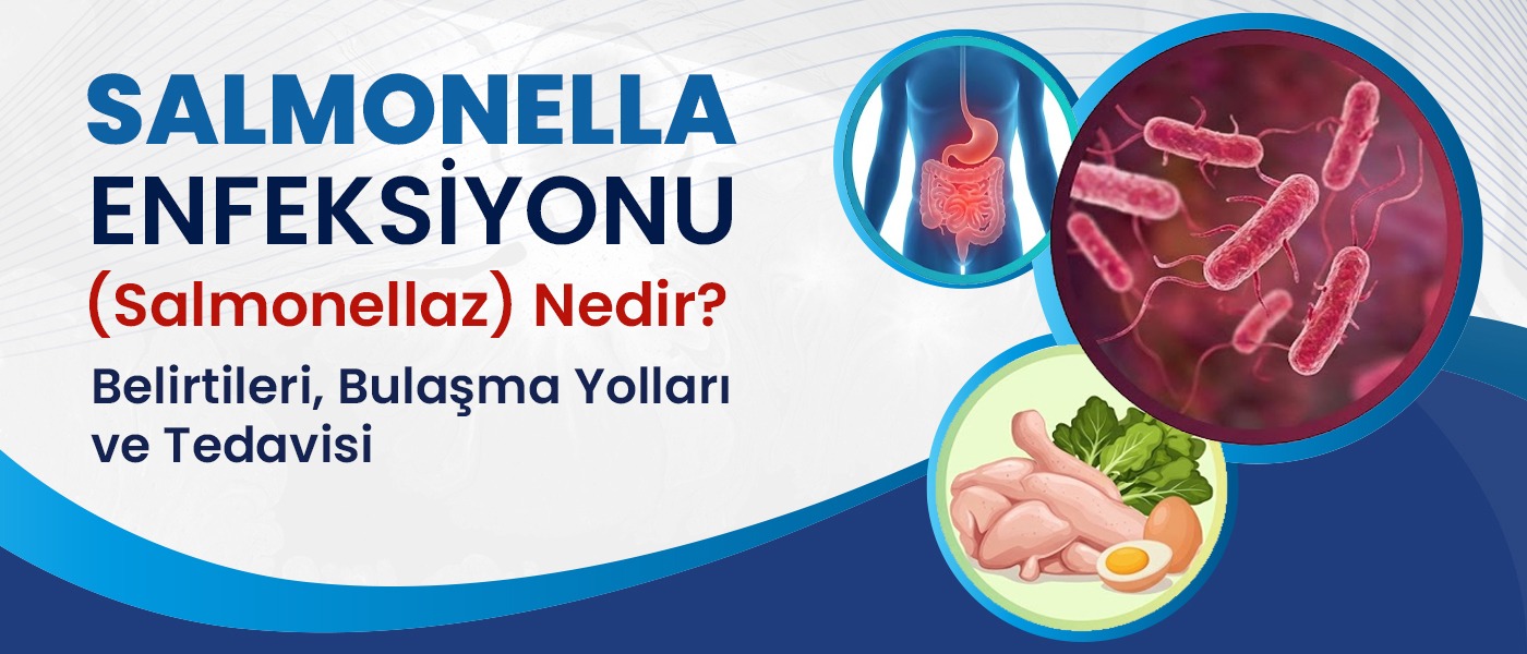 Salmonella Enfeksiyonu (Salmonelloz) Nedir? Belirtileri, Bulaşma Yolları ve Tedavisi
